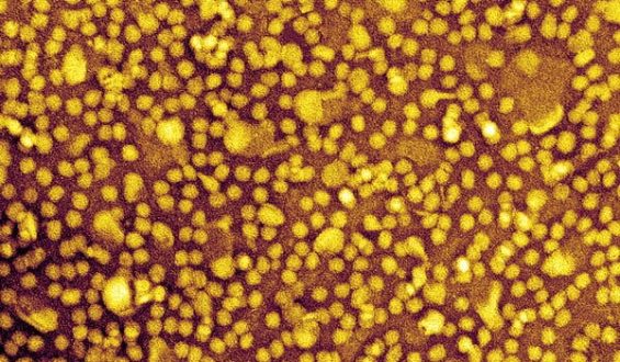 Experimental Gene-Editing Drug Shows Promise in Reducing Cholesterol