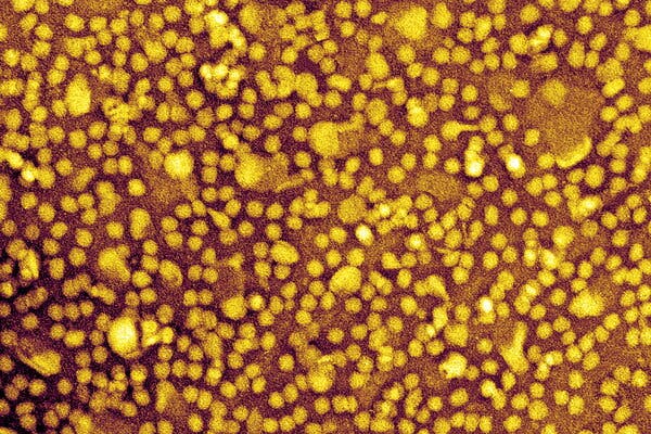 Experimental Gene-Editing Drug Shows Promise in Reducing Cholesterol