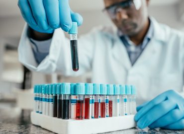 Biological Age and Dementia Risk: New Insights