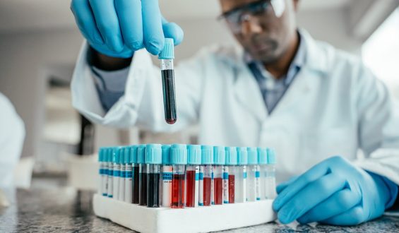 Biological Age and Dementia Risk: New Insights