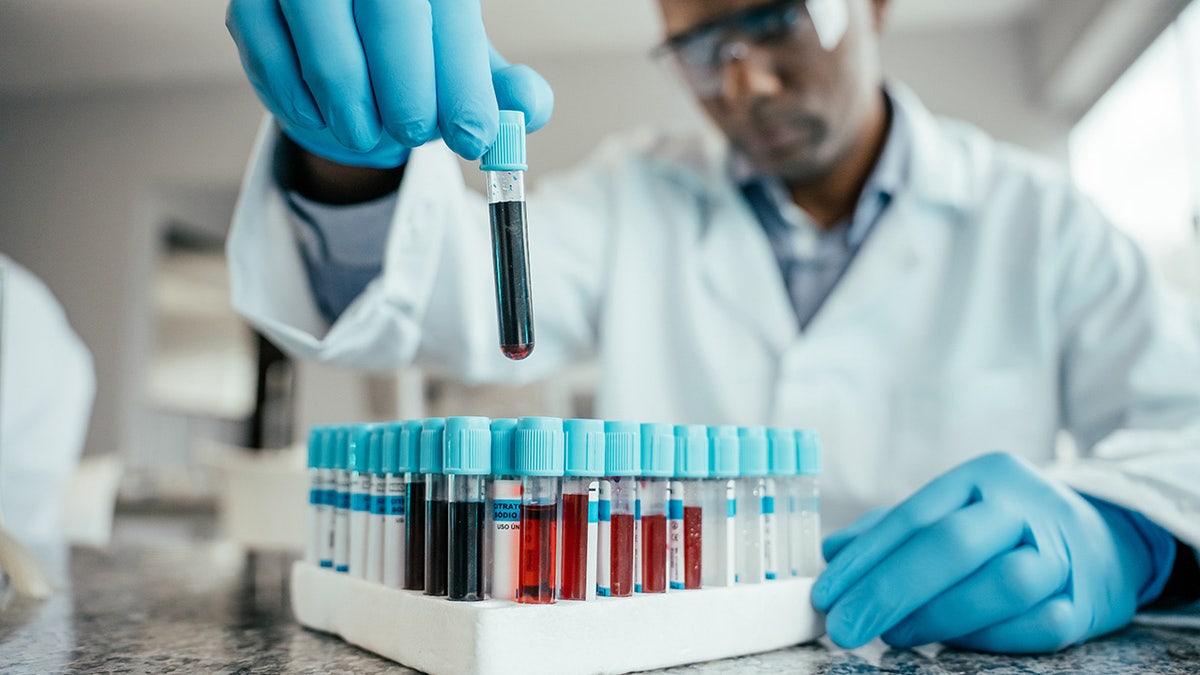Biological Age and Dementia Risk: New Insights