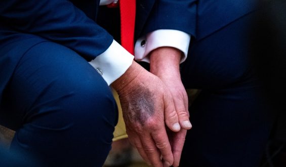 President Trump Set for Medical and Dental Check-Up