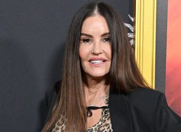Janice Dickinson’s New Look after Facial Rejuvenation