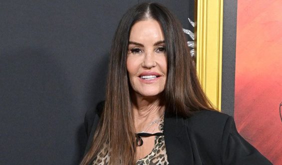 Janice Dickinson’s New Look after Facial Rejuvenation