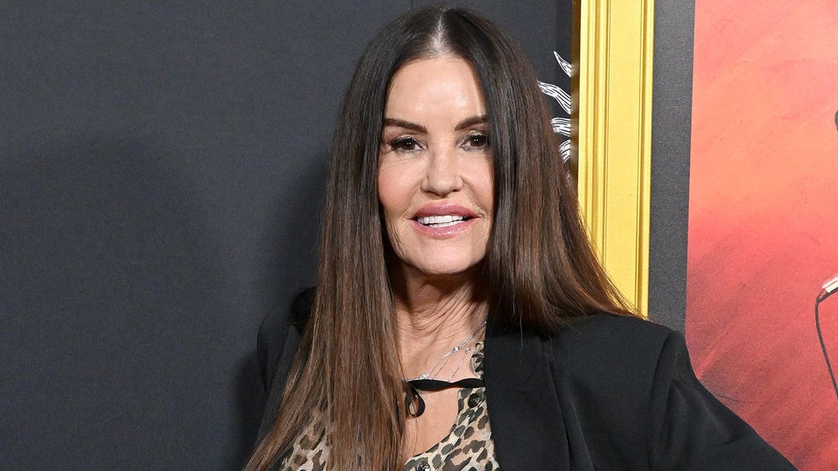 Janice Dickinson’s New Look after Facial Rejuvenation