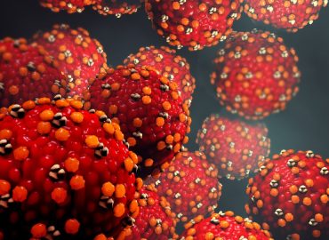 Measles Exposure at Los Angeles International Airport and Nearby Hotel