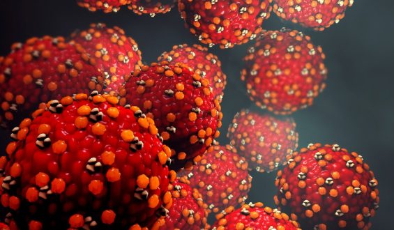Measles Exposure at Los Angeles International Airport and Nearby Hotel