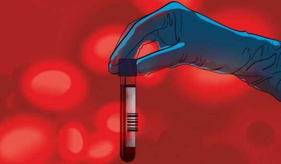 Advancements in Blood Tests Transforming Cancer Care