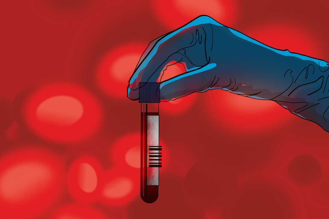 Advancements in Blood Tests Transforming Cancer Care