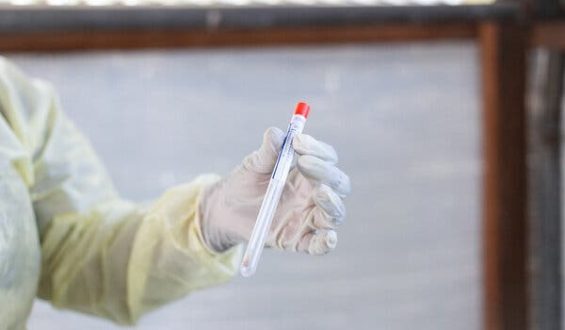 Dutch Virologist Investigated for Alleged Smuggling of Biological Materials