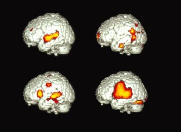 Study Reveals Shared Brain Processing for Bilingual Speakers