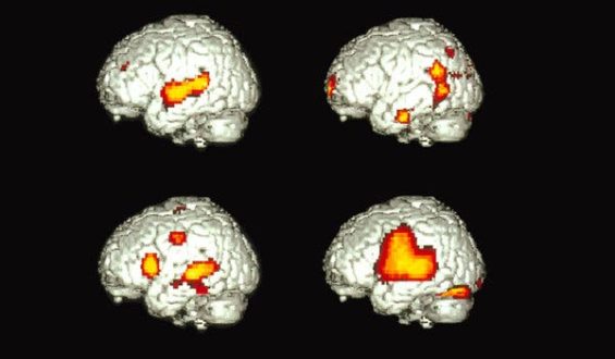 Study Reveals Shared Brain Processing for Bilingual Speakers