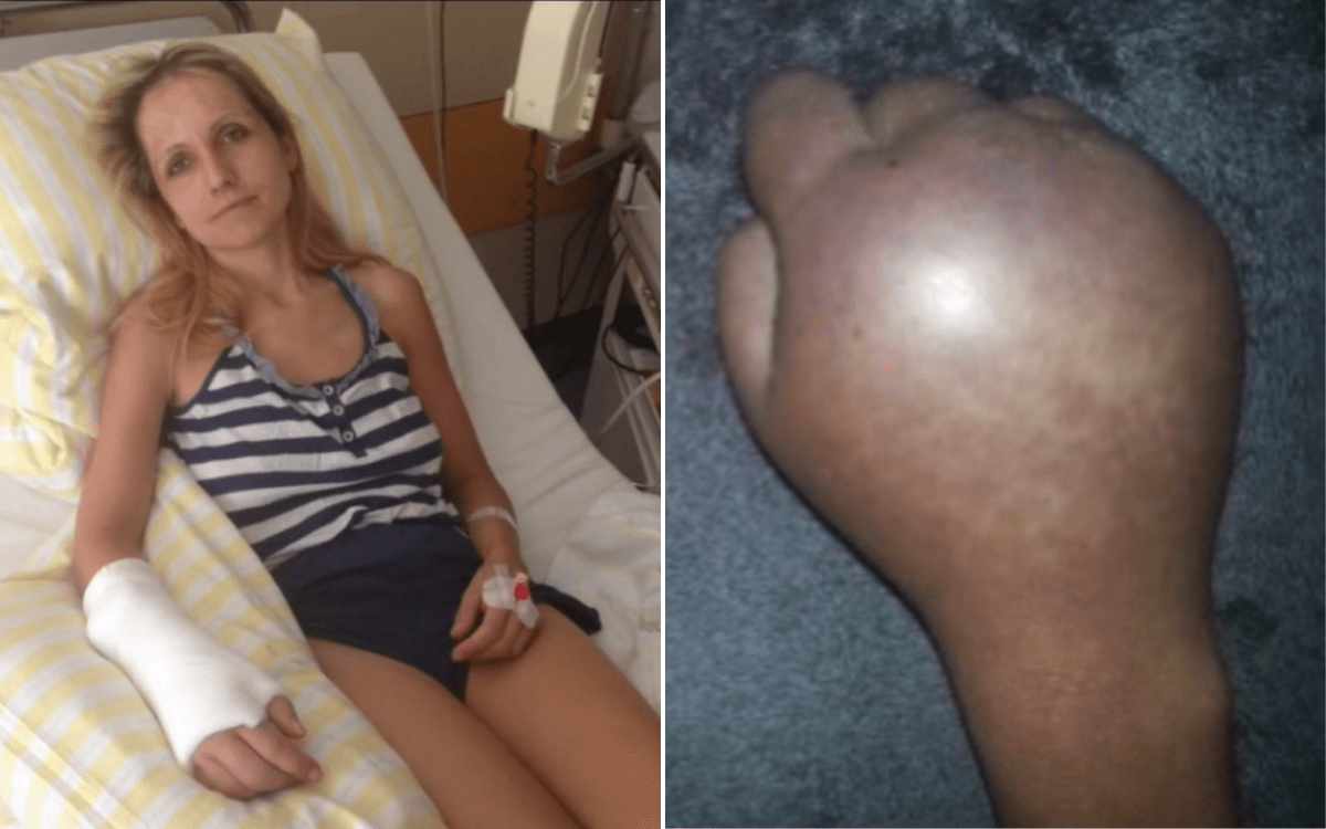 Facing Life with CRPS: A Journey of Resilience