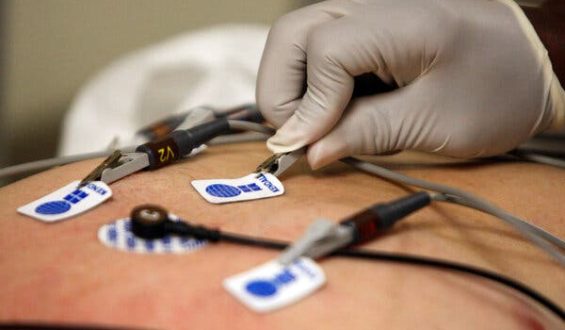 AI Programs Enhance Heart Disease Detection Through ECG Analysis