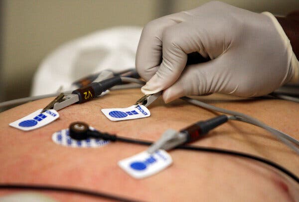 AI Programs Enhance Heart Disease Detection Through ECG Analysis