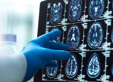 Scientists Discover a Protein Potentially Preventing Brain Changes from Alzheimer’s and Parkinson’s