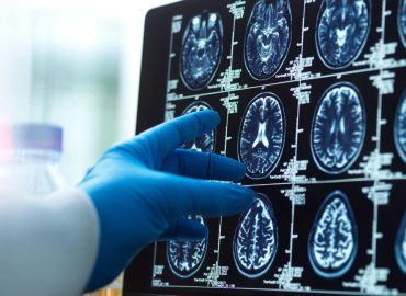 Copper-Based Drug Shows Promise Against Alzheimer’s Disease