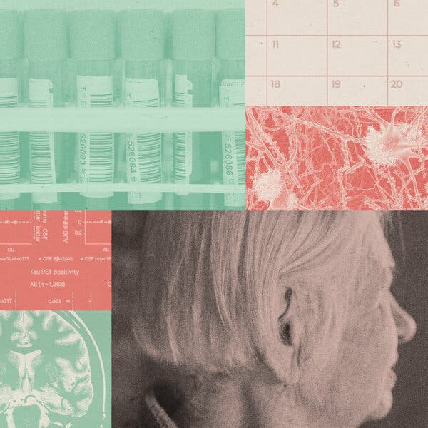 Blood Tests Hold Potential for Alzheimer’s Diagnosis and Prediction