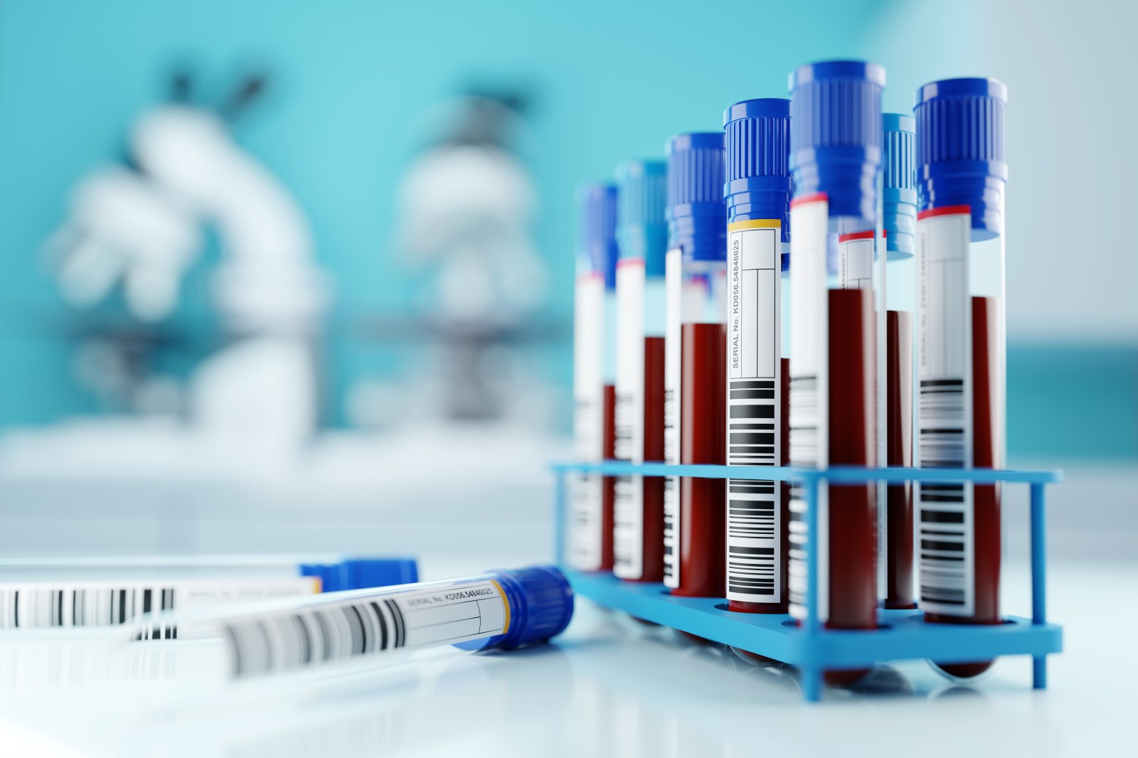 Blood Test Could Predict Colorectal Cancer Recurrence and Metastasis