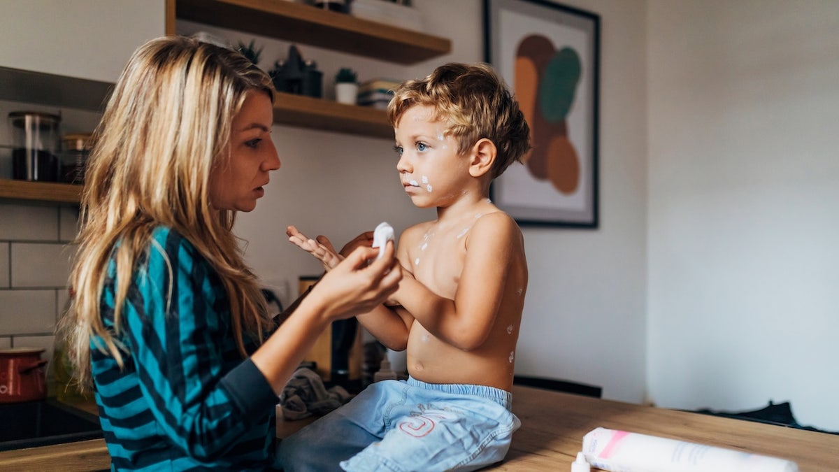 Measles Resurgence: A Growing Public Health Concern in the U.S.