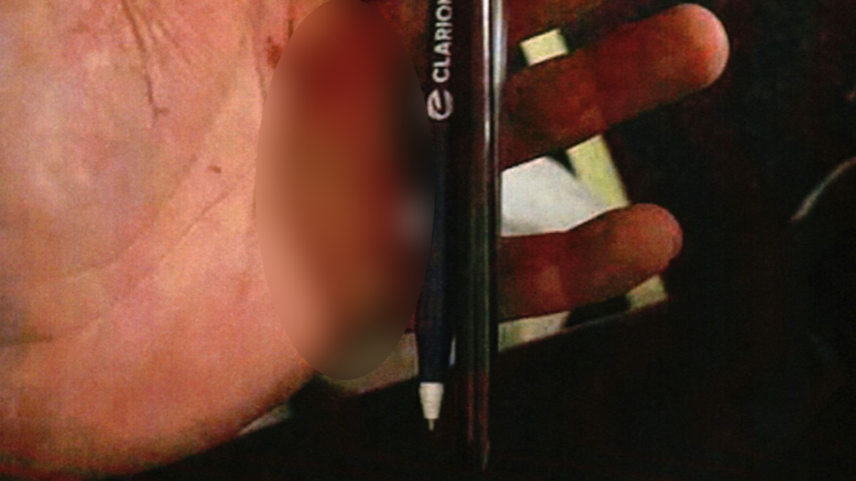 Flight Incident Involving Assault with Improvised Weapon
