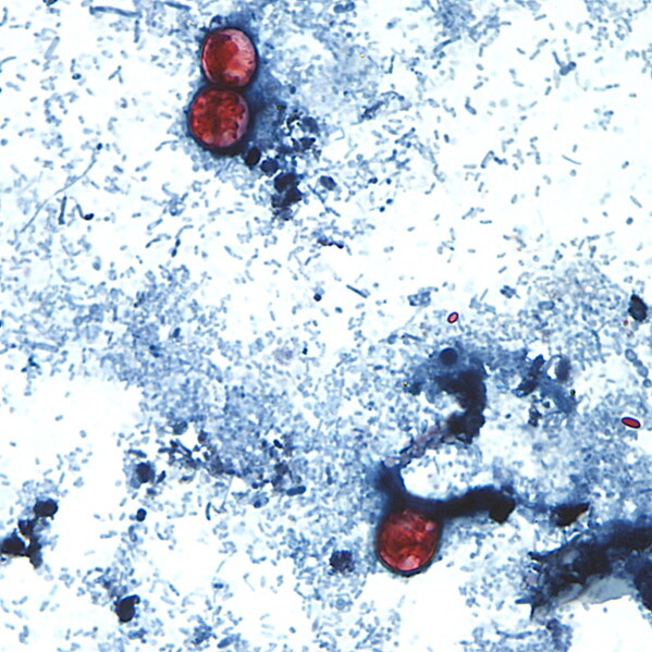 Focus on Taylor Farms’ Lettuce in Cyclospora Outbreak