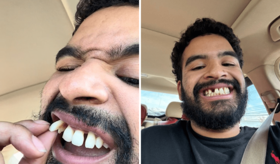 Young Teacher Shares Life-Changing Battle with Periodontal Disease