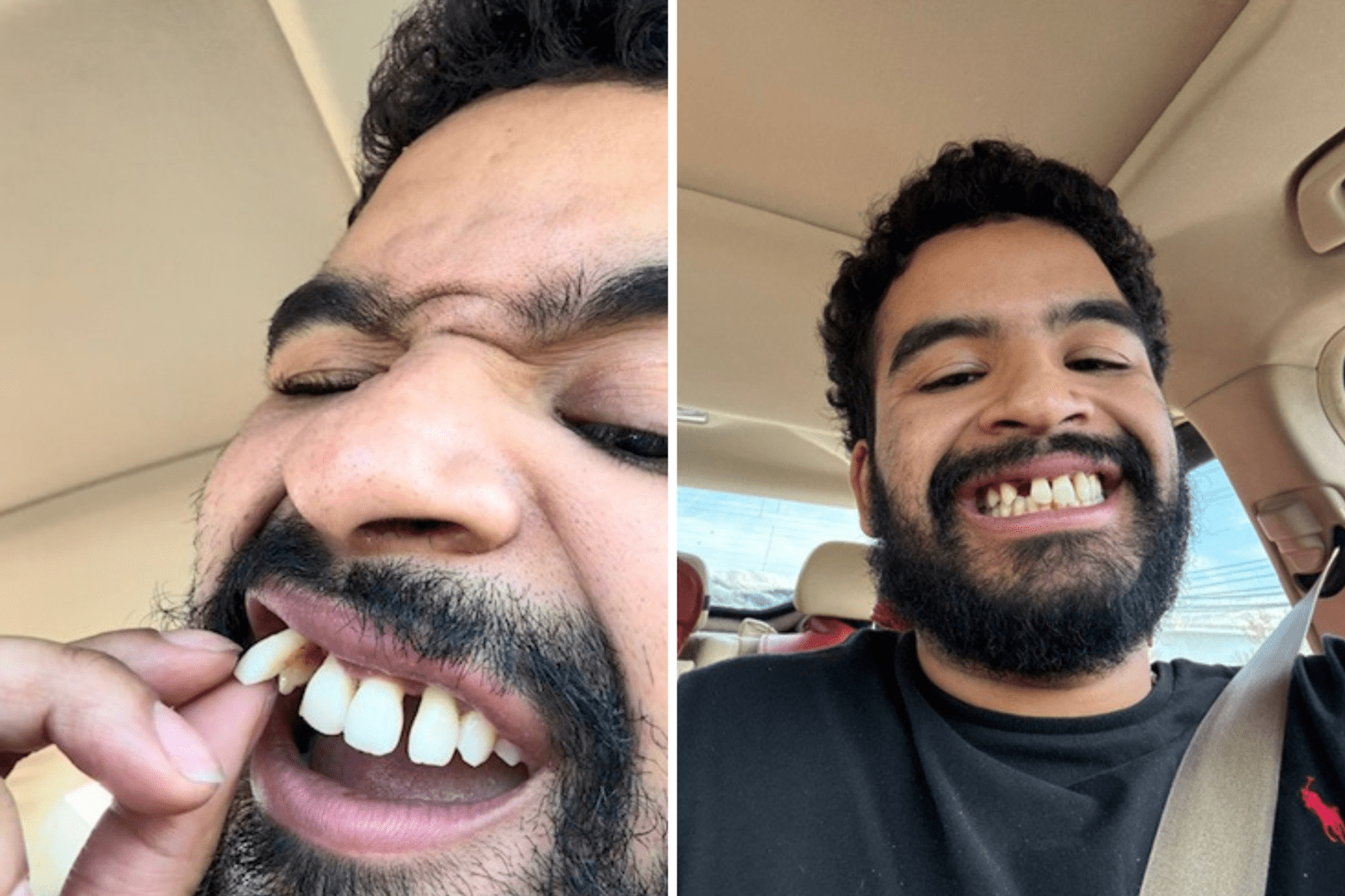 Young Teacher Shares Life-Changing Battle with Periodontal Disease