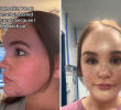 Woman’s Ordeal from Forehead Lump to Vision Loss