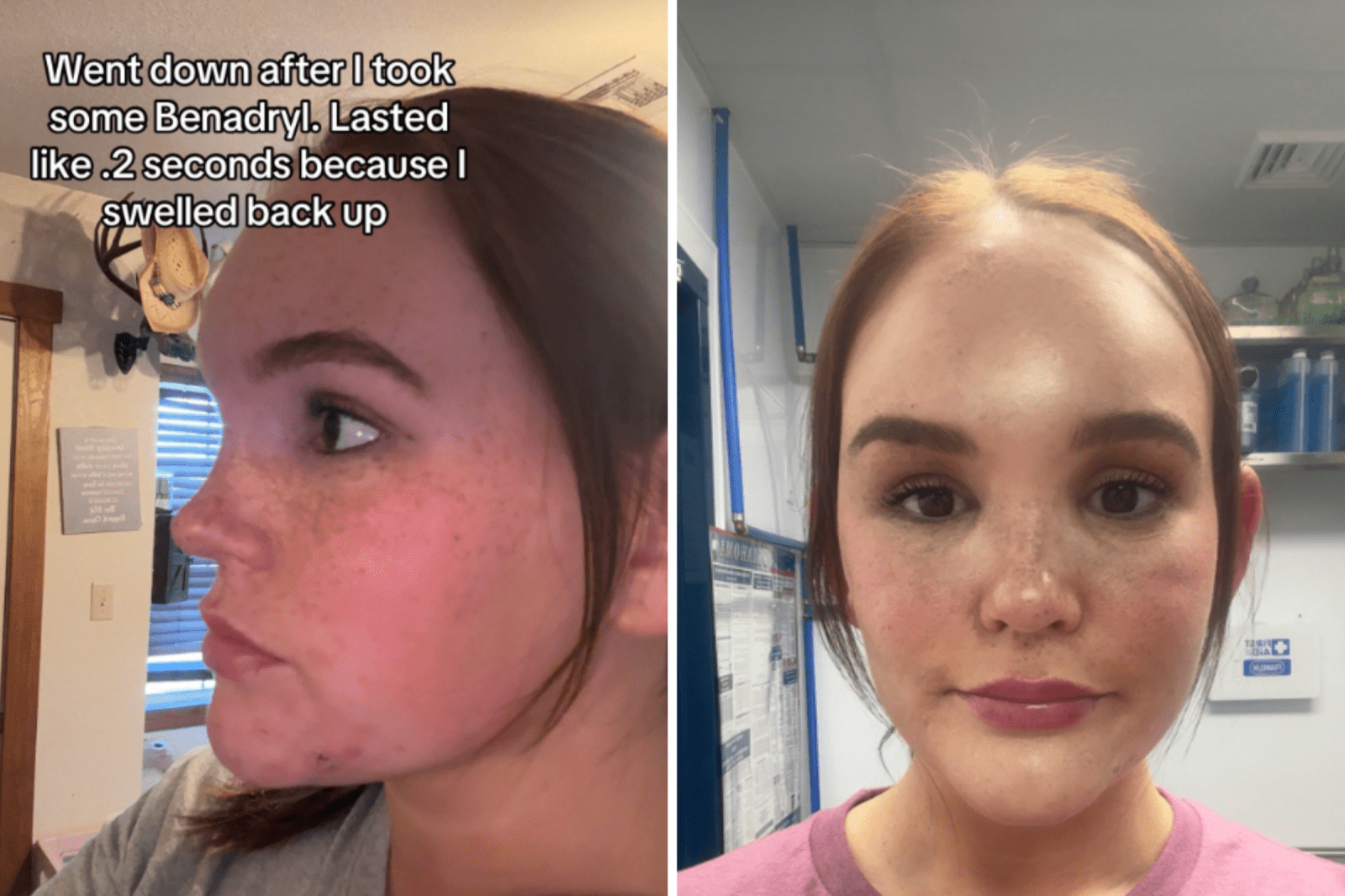 Woman’s Ordeal from Forehead Lump to Vision Loss