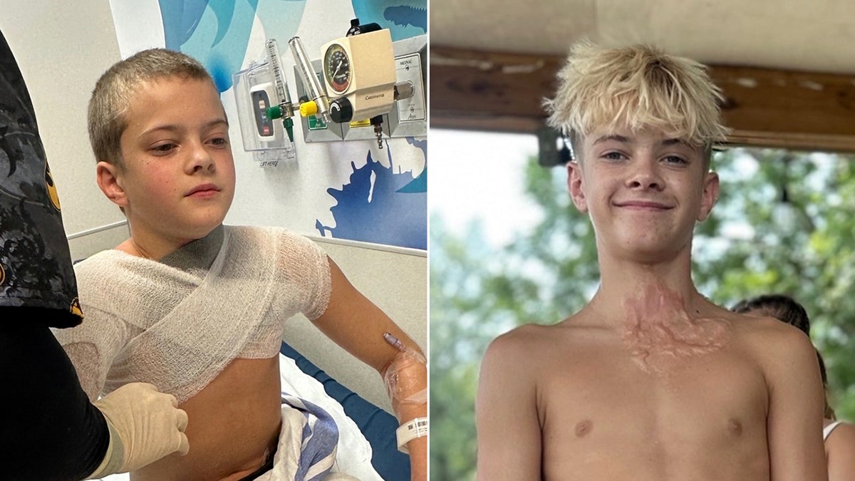 The Dangers of a Social Media Trend: An Alabama Teen’s Experience