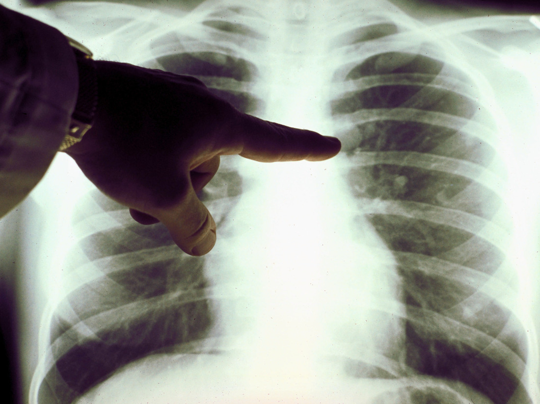 History and Advances in Cancer Treatment