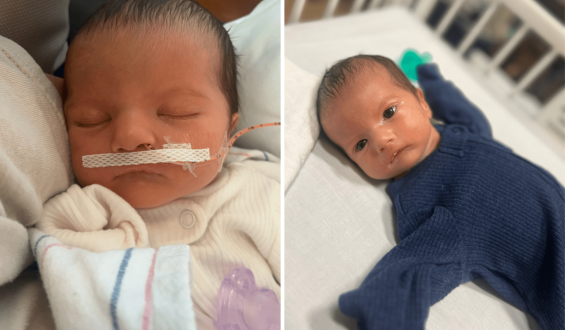 Mother Shares Her Toddler’s Journey with Poland-Moebius Syndrome