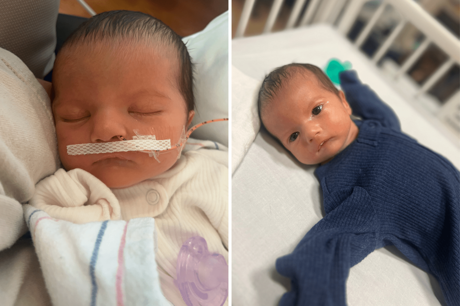 Mother Shares Her Toddler’s Journey with Poland-Moebius Syndrome