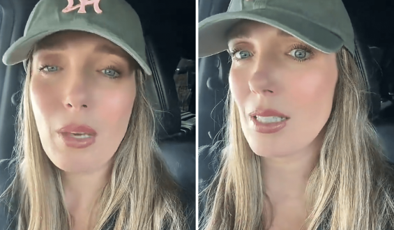 Woman Warns About Botox Risks After Severe Side Effects