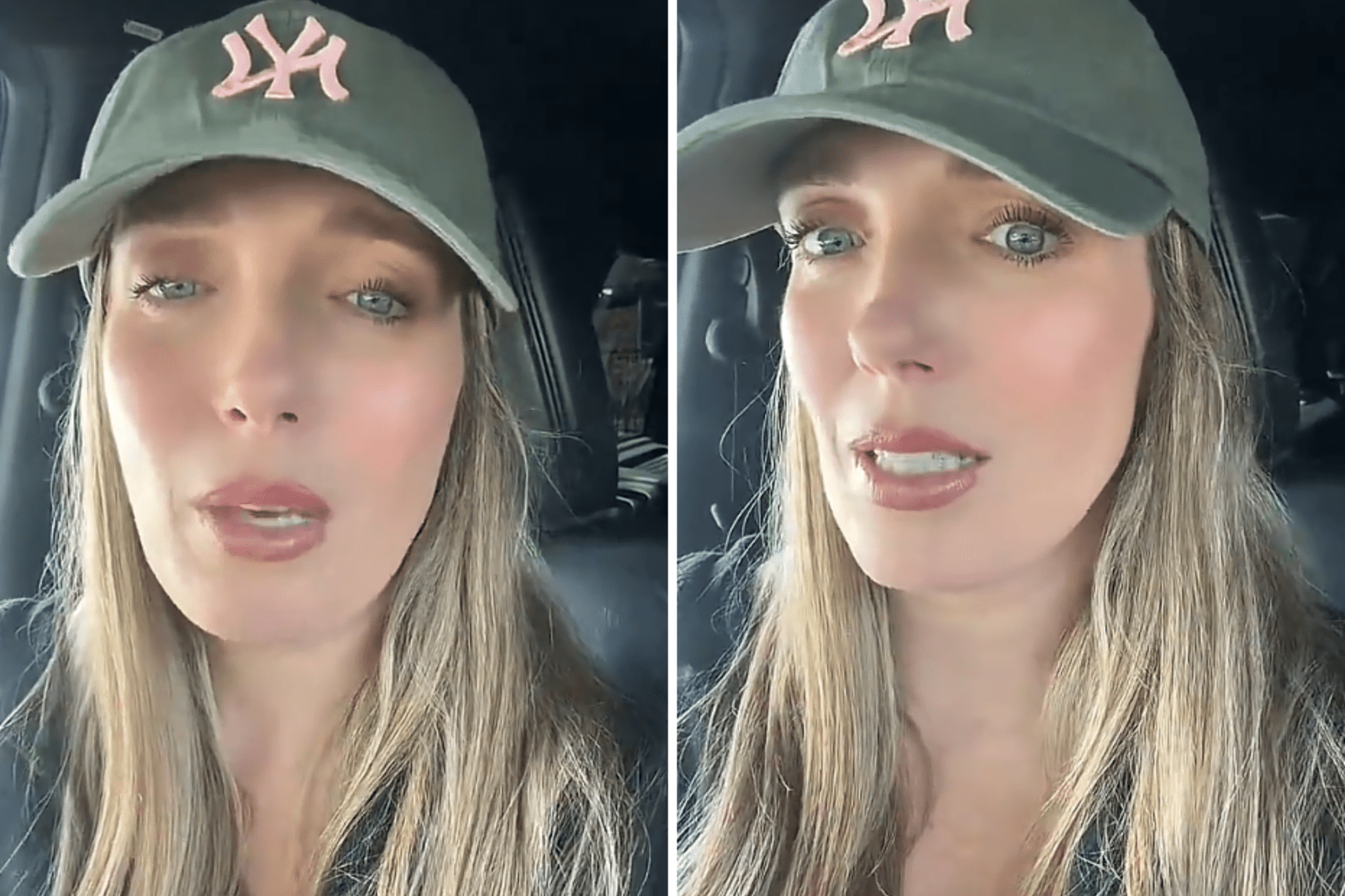 Woman Warns About Botox Risks After Severe Side Effects