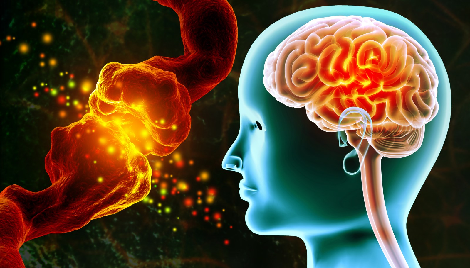 AI-Based Brain Age Estimation in Predicting Dementia