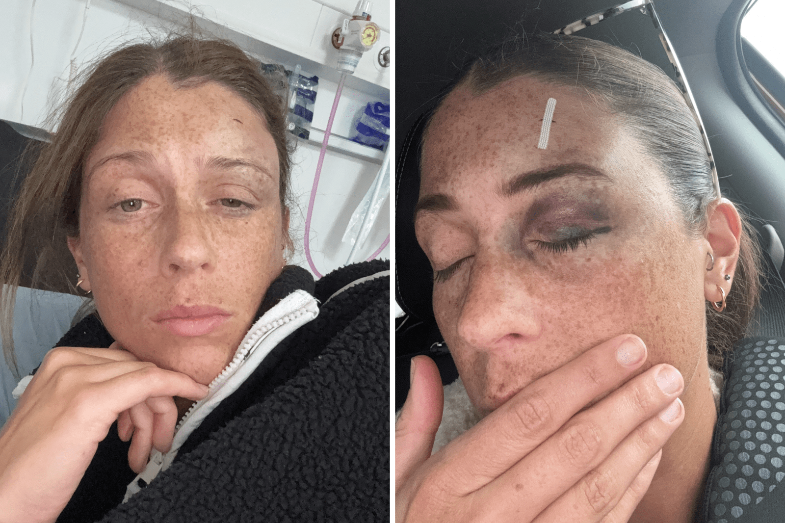 Woman Experiences Withdrawal Symptoms After Stopping Contraceptive Injection