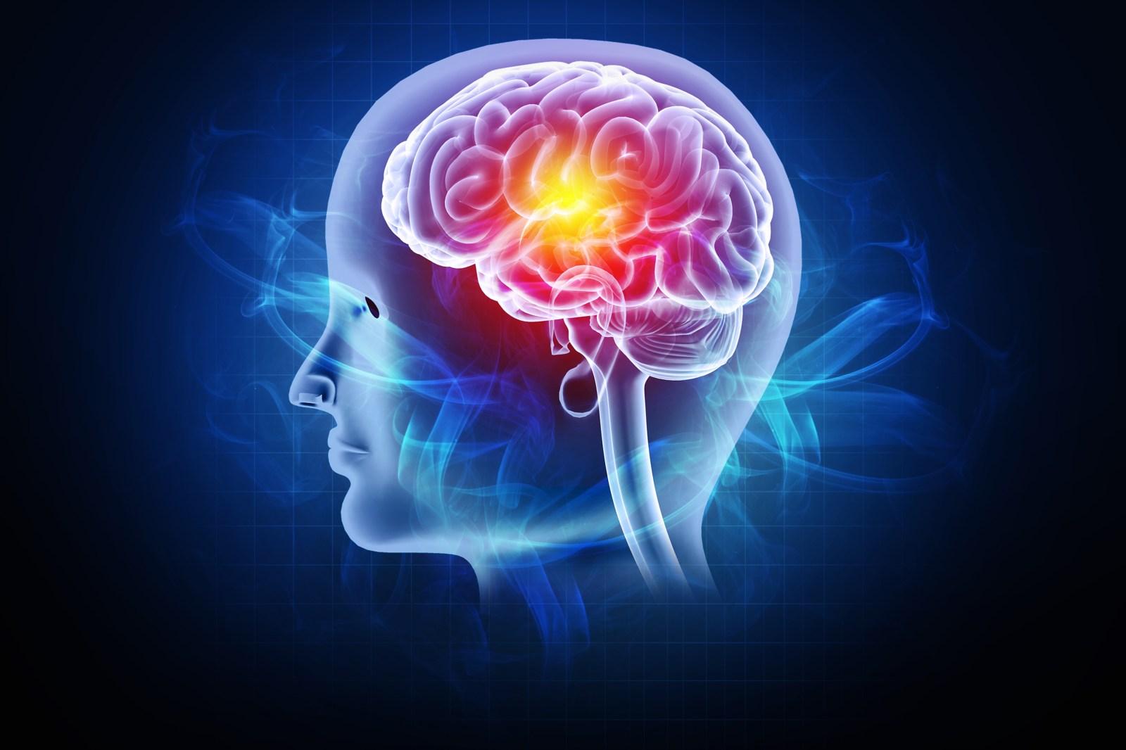 The Role of Deadlifts and Exercise in Brain Health