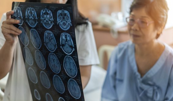 Dementia Risk Persists Into Advanced Age