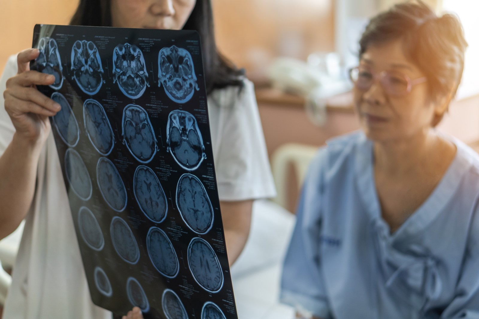 Dementia Risk Persists Into Advanced Age