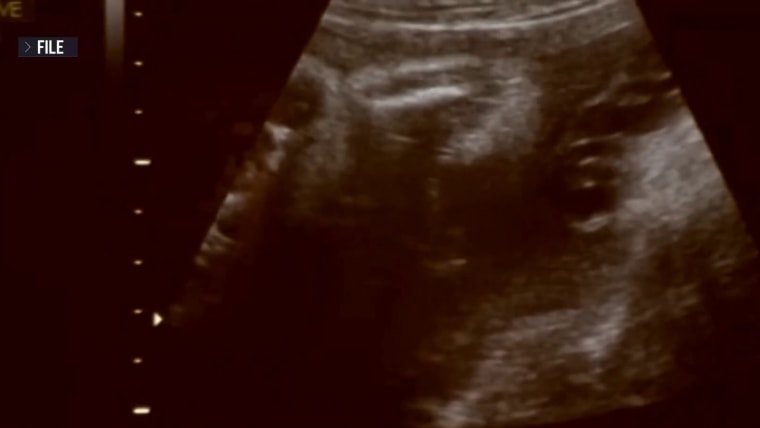 Legal Battle Over Surrogate Birth and Child’s Heart Surgery