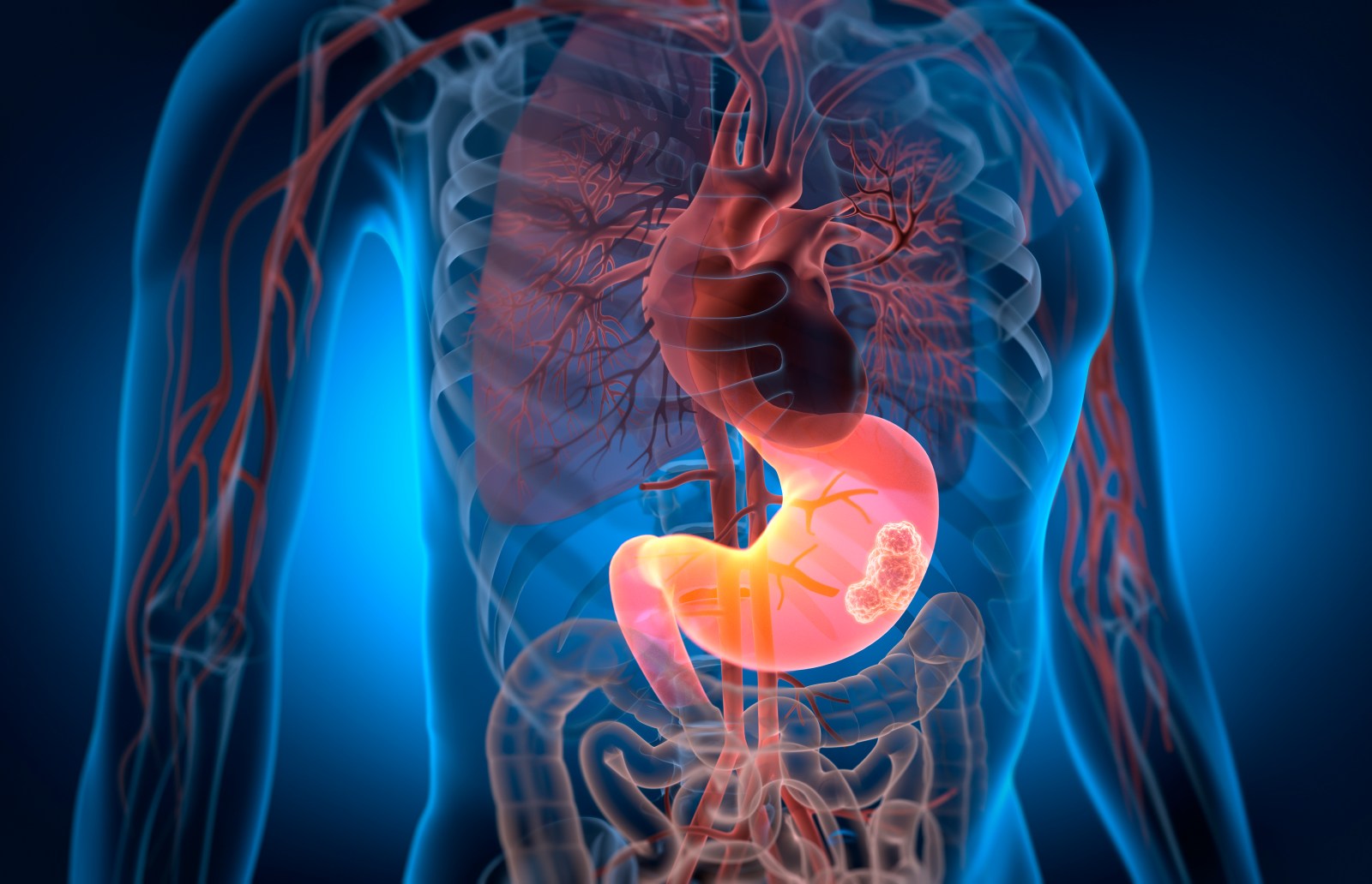 Innovative Approach to Combat Solid Tumors with CAR-T Therapy