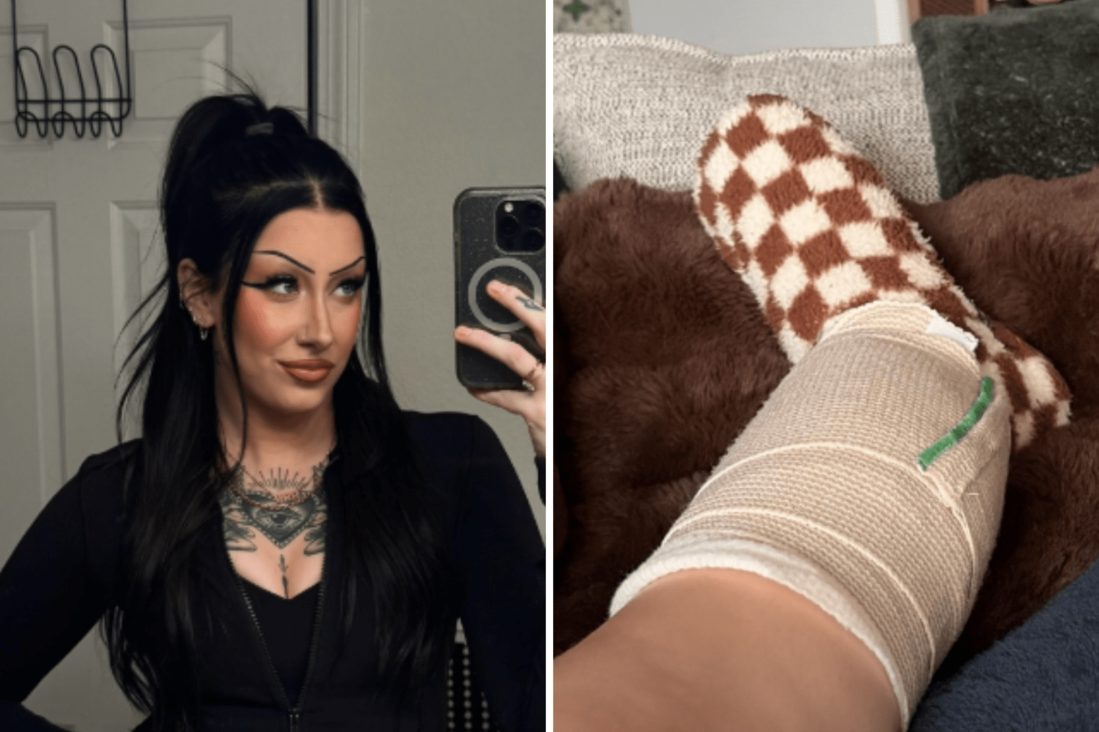 Young Woman’s Skin Cancer Experience Highlights Importance of Skin Checks