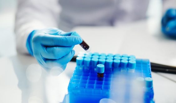 DNA Analysis Predicts Blood Cancer Progression Ahead of Traditional Tests