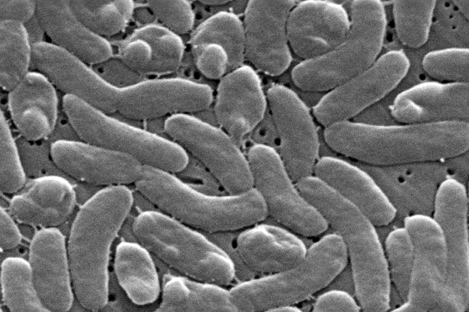 Rising Cases of Vibrio Vulnificus Infections in the U.S.