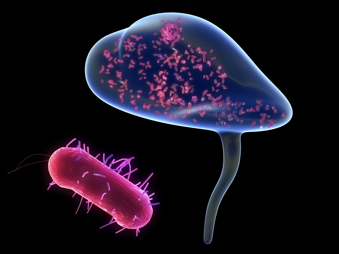 Understanding UTIs and the Role of Recurring Infections