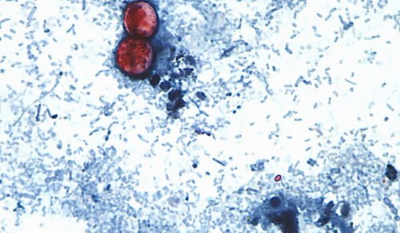 Taylor Fresh Foods Recalls Products Due to Salmonella Concerns