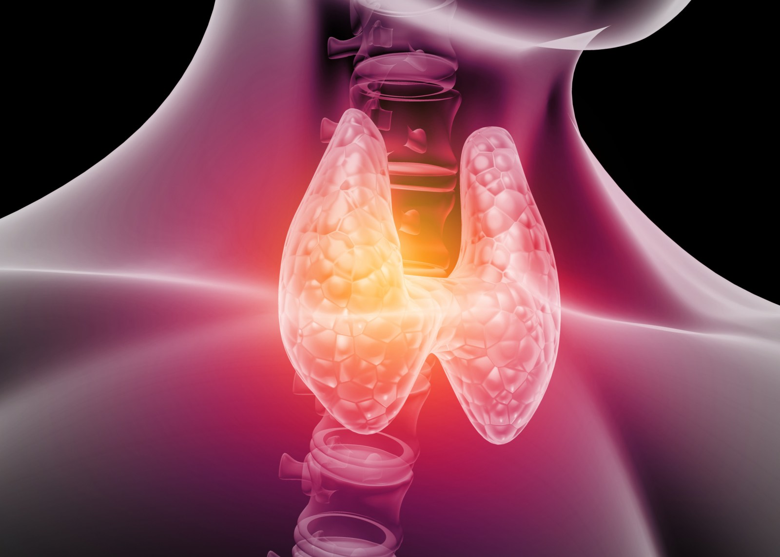 Routine Checkup Reveals Hidden Thyroid Cancer in Florida Woman