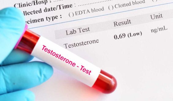 Understanding the Push for Testosterone Screening and Therapy